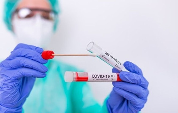 79 са новите случаи на коронавирус у нас  Направени са 484