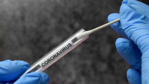 328 са новите случаи на коронавирус у нас Направени са