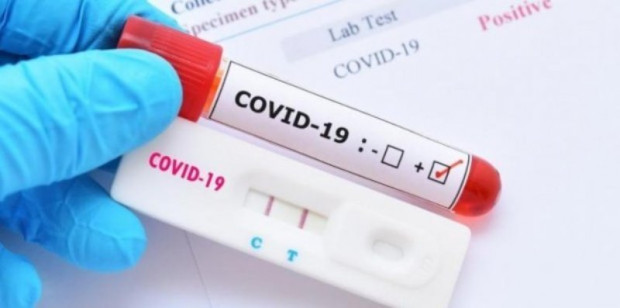 TD 310 са новите случаи на коронавирус у нас  Направени са 2