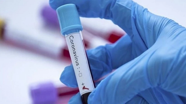 586 случая на коронавирус са регистрирани през последното денонощие в