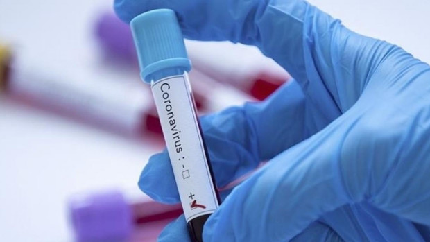 403 са новите случаи на коронавирус у нас  Направени са 2