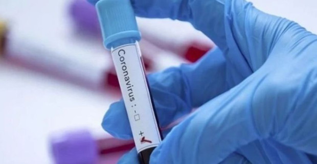 </TD
>294 са новите случаи на коронавирус у нас. Направени са 2