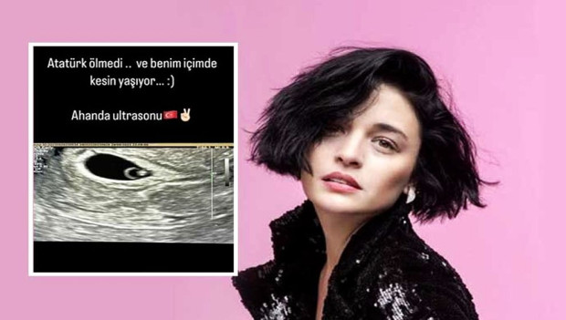 Турската звезда Гонджа Вуслатери, която е бременна с първото си