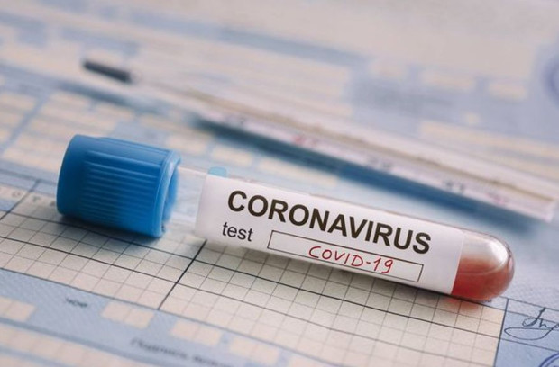 219 са новите случаи на коронавирус у нас  Направени са 2