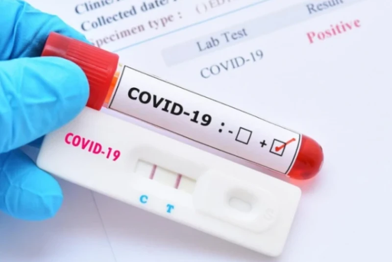 65 �� ������ ������ �� COVID-19 � �����