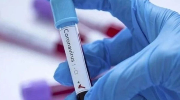 197 са новите случаи на коронавирус у нас. Направени са 1