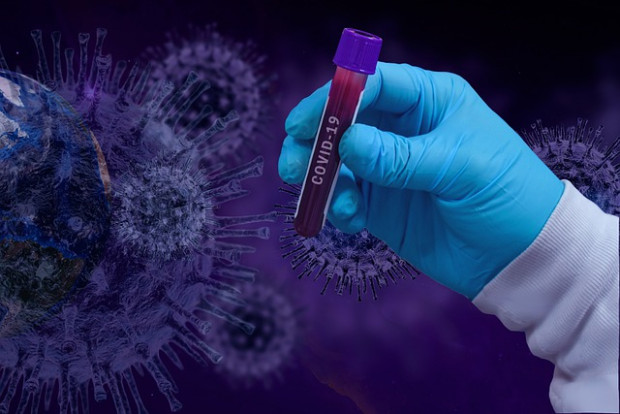 </TD
>164 са новите случаи на коронавирус у нас. Направени са 1682