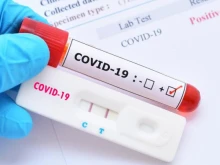 Над 340 са пациентите с COVID-19, които се лекуват в болница