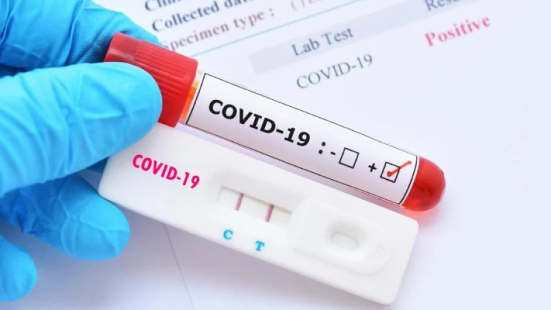 ��� 340 �� ���������� � COVID-19, ����� �� ������� � �������