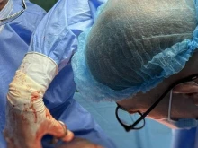 11-килограмова киста оперираха в Пловдив, апаратурата не успяла да я измери
