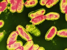 "100-дневната кашлица": Предупреждение за силно заразна инфекция в Европа