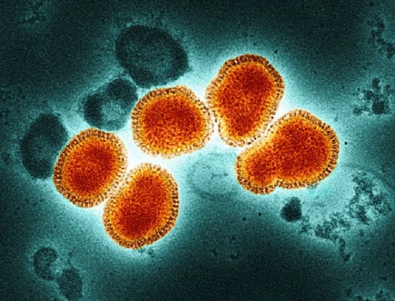 Първи случай за сезона на заразен с грипен вирус A