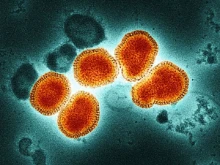 Първи случай за сезона на заразен с грипен вирус A