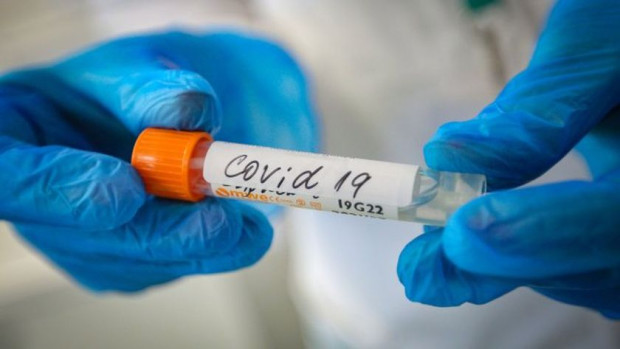 214 са новите случаи на коронавирус у нас. Направени са