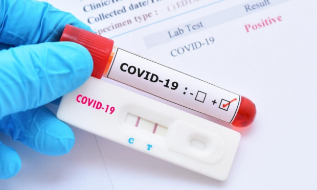 TD 38 са новите случаи на коронавирус у нас Направени са 522