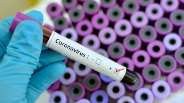 </TD
>133 са новите случаи на коронавирус у нас за последното денонощие.