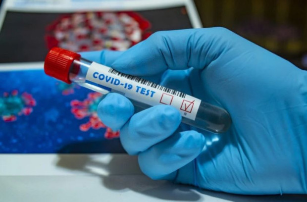 66 са новите случаи на коронавирус у нас  Направени са 517 теста