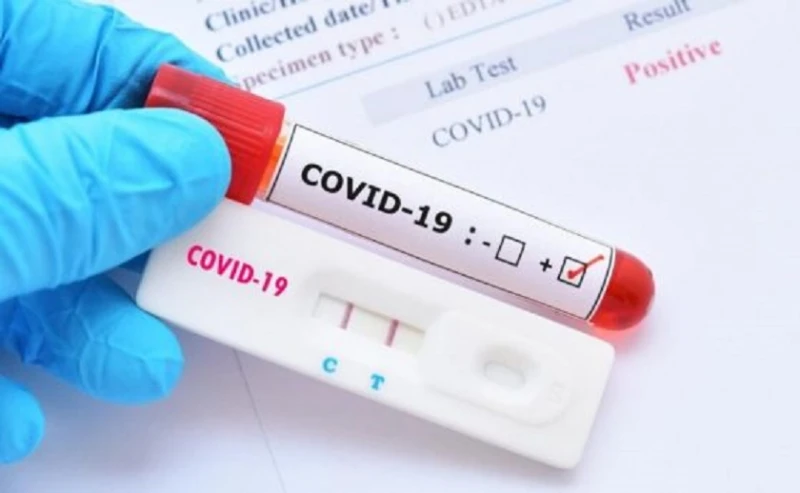 79 ������������ � ����� � COVID