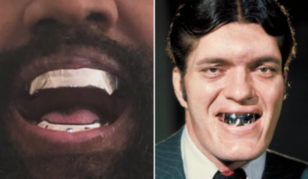 Американският рапър Кание Уест извади всичките си зъби и ги