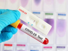 COVID-19: 6 новозаразени има в Пловдив