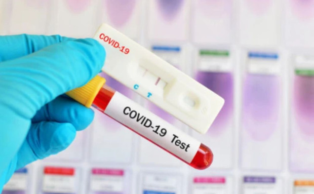 TD 120 са новите случаи на коронавирус у нас Направени са