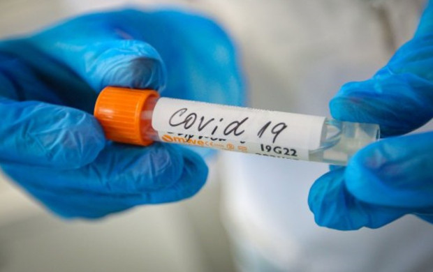 </TD
>62 са новите случаи на коронавирус у нас. Направени са