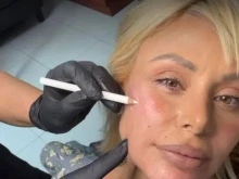 Гущерова припечелва от "Ергенът", планира нова корекция на лицето