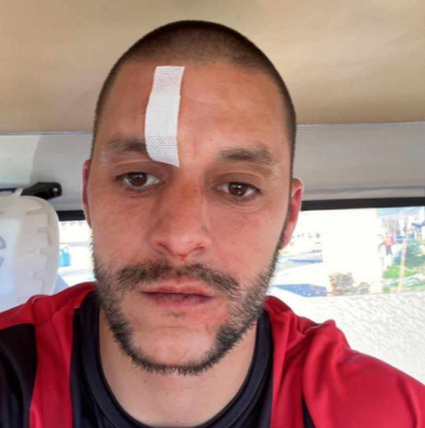Футболист на Атлетик (Куклен) с 4 шева в болница след жесток побой на мач в Несебър