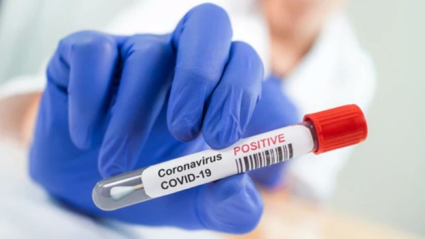 3 са новите случаи на коронавирус у нас Направени са