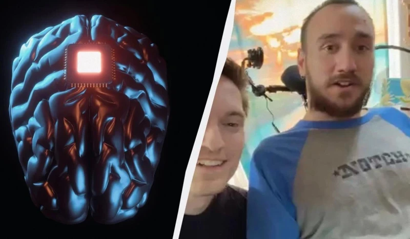 Илон Мъск показа първия човек с чип в мозъка