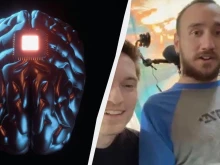 Илон Мъск показа първия човек с чип в мозъка