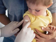 Доц. Мангъров: Морбили се среща най-често при деца, които не са ваксинирани