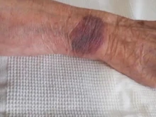 Проверяват упражнявано ли е насилие върху 104-годишна жена в болница във Видин