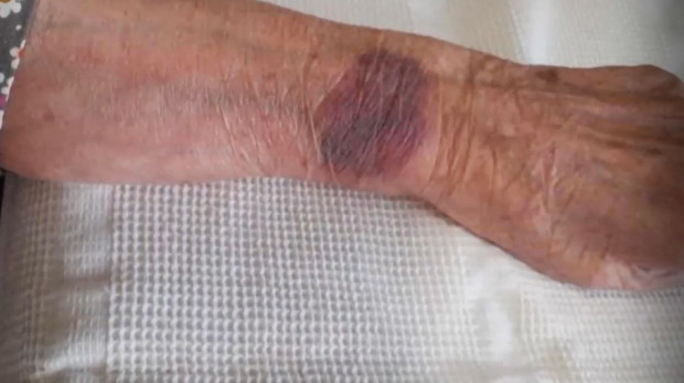 Снимка: Проверяват упражнявано ли е насилие върху 104-годишна жена в болница във Видин