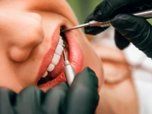 Зъболекар предупреждава: Миенето на зъбите без достатъчно вода може да доведе до пожълтяването им