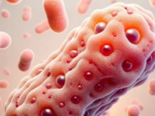  :    PCR     