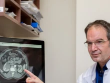 Доц. д-р Еленко Попов, ИСУЛ: Брахитерапията има 95% успеваемост при рака на простатата