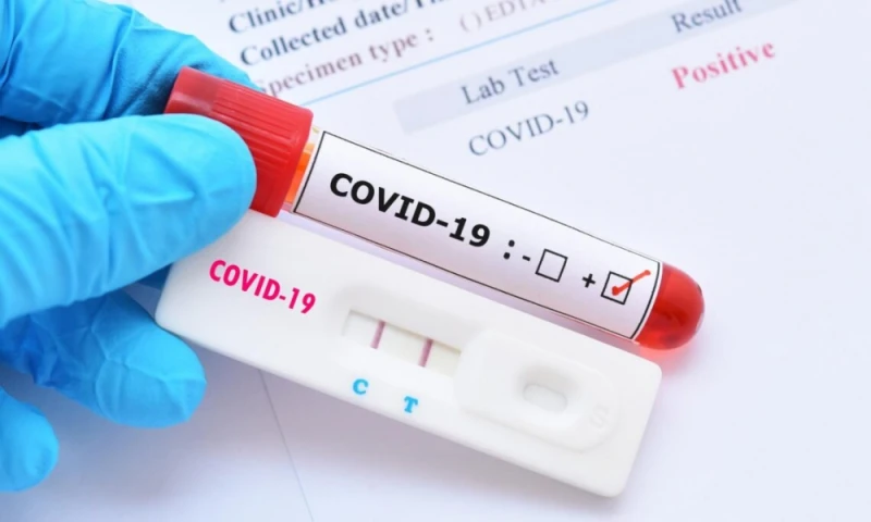 Д-р Илиев за новия вариант на COVID-19, наречен "флирт": Не е лек, но не е по-опасен