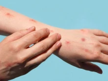 СЗО в готовност за международна извънредна ситуация