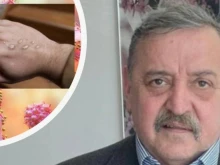 Проф. Кантарджиев: Не пипайте очите си, разпространява се