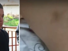 Агресия в детска градина, майка си извади медицинско