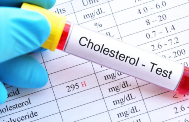Учени: Нивата на "добрия" холестерол са свързани с повишен риск от болестта на Алцхаймер