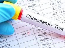 Учени: Нивата на "добрия" холестерол са свързани с повишен риск от болестта на Алцхаймер