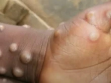 ������� ���������� ����� ������ �� ��� ������� �� ����������� �����
