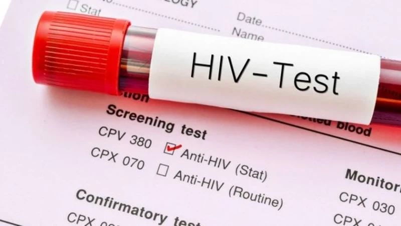 Случай на HIV регистрираха здравните власти във Великотърновско