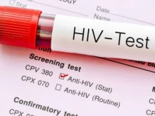 Случай на HIV регистрираха здравните власти във Великотърновско