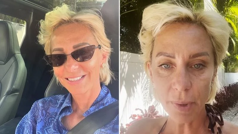 Нана продължава да се бори със сериозните поражения по лицето си