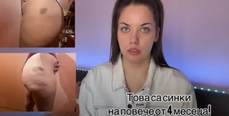 Веселка изрева: Съжалявам, че се оперирах в Турция - излъгаха ме!