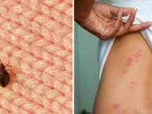 Нашествие от безсмъртни дървеници подлуди страна в Европа