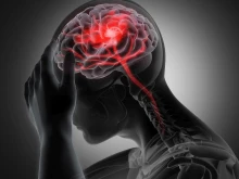 Ако имате тези симптоми, най-вероятно получавате инсулт